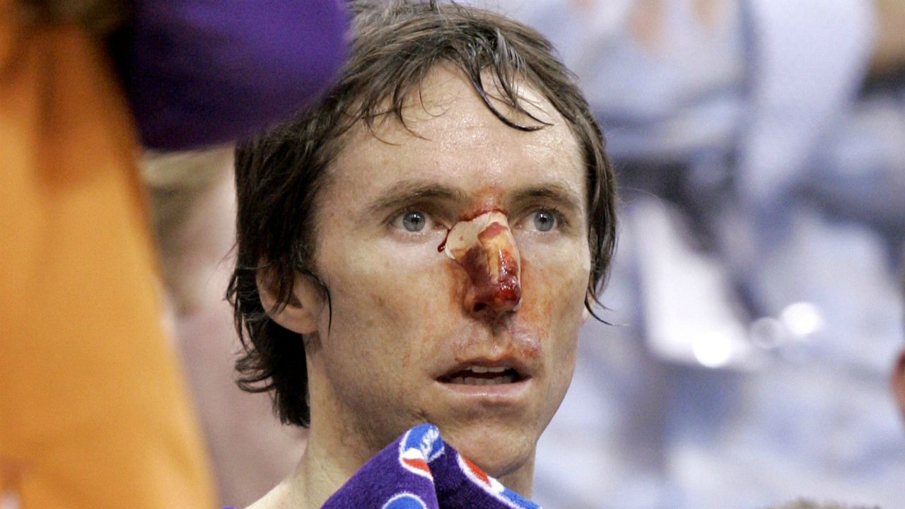 steve nash bloody nose shirt